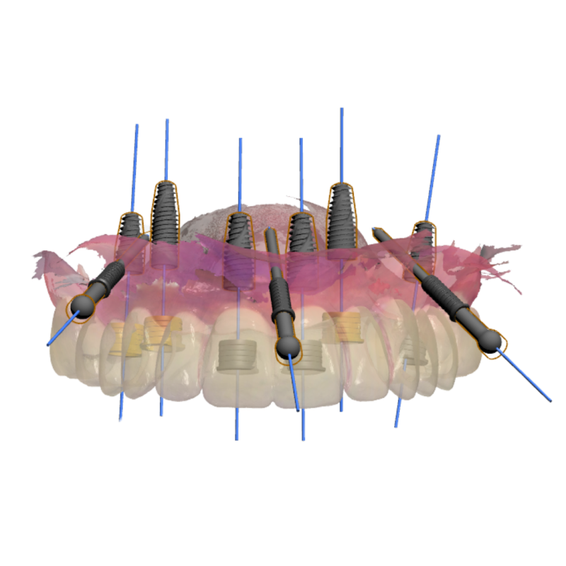 laboratorio protesico dental en bilbao